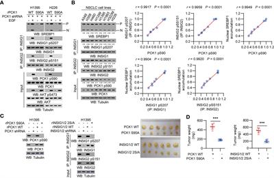 Prognostic Impact of PCK1 Protein Kinase Activity-Dependent Nuclear SREBP1 Activation in Non-Small-Cell Lung Carcinoma